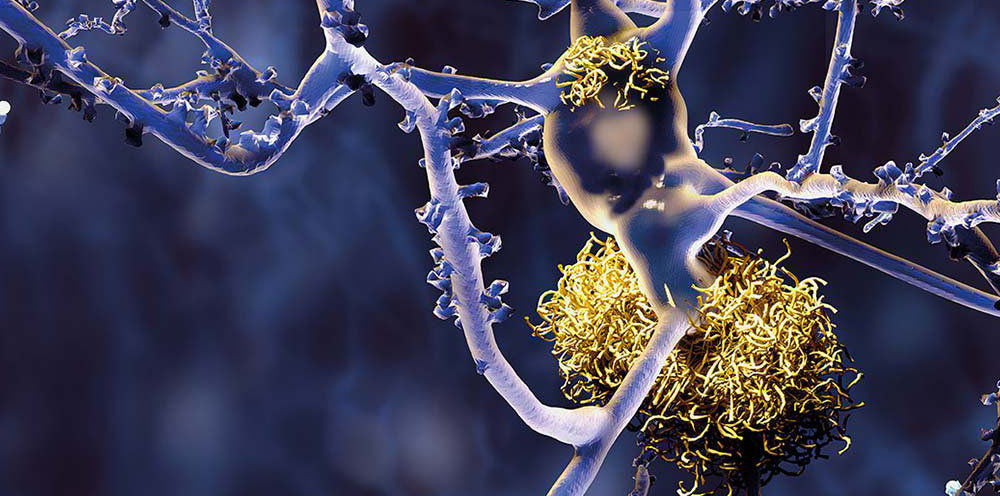 Detection of Alzheimers blood-based biomarkers