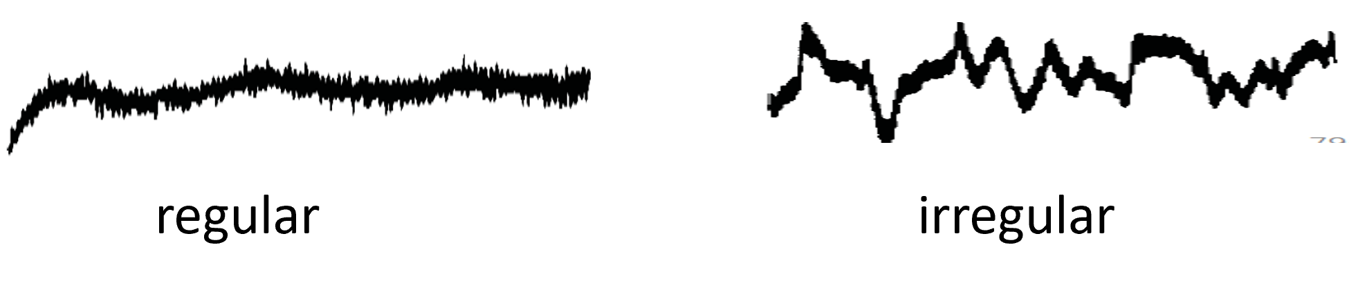 Noisy Baselines